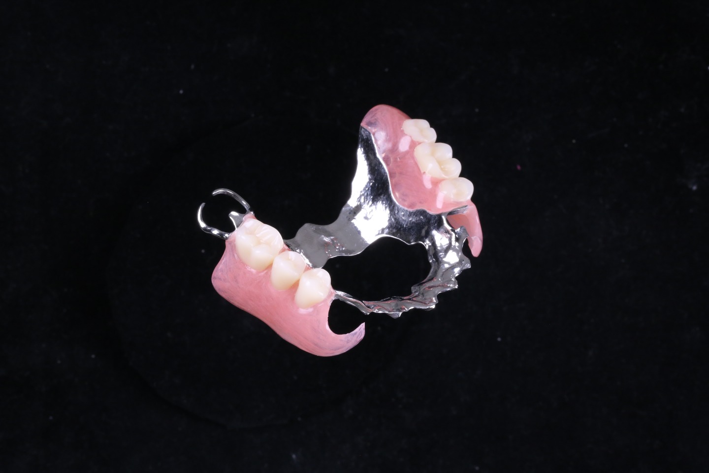 自由診療：超精密義歯+チタン床
